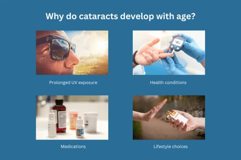 Why do cataracts develop with age