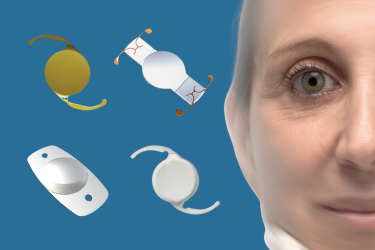 Choosing the Right Intraocular Lens (IOL)