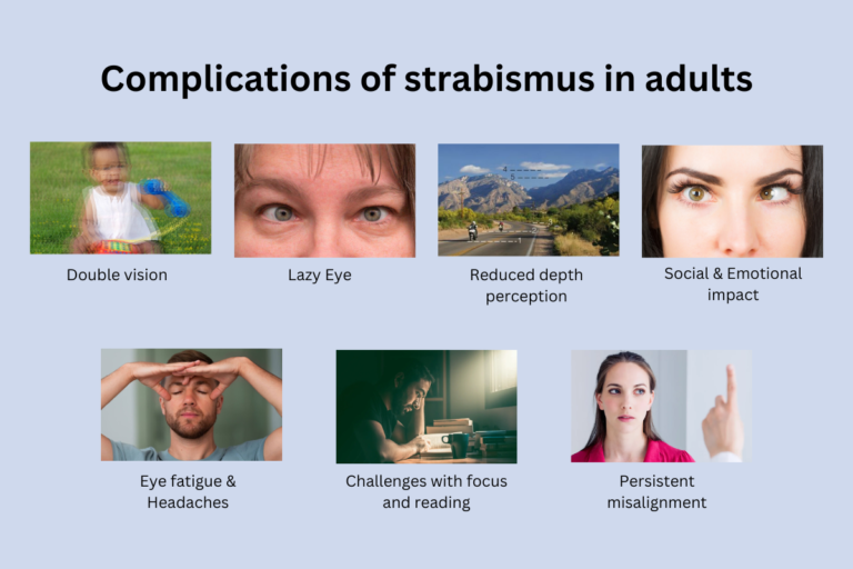 Complications of strabismus in adults