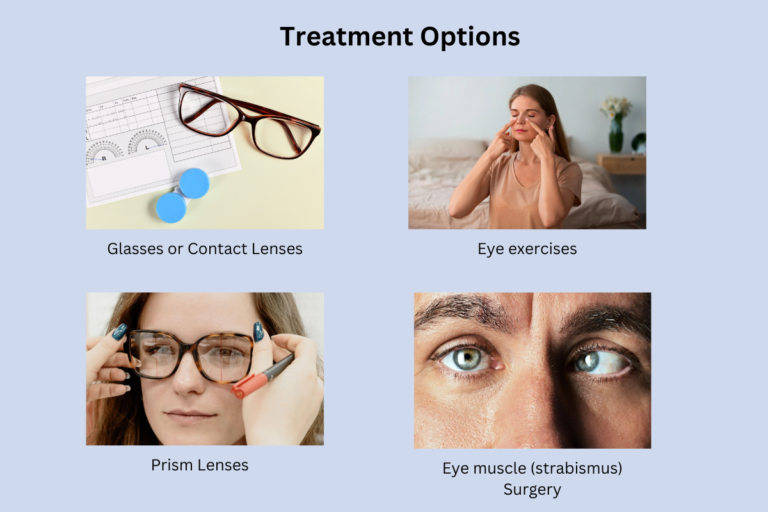 Exotropia Treatment