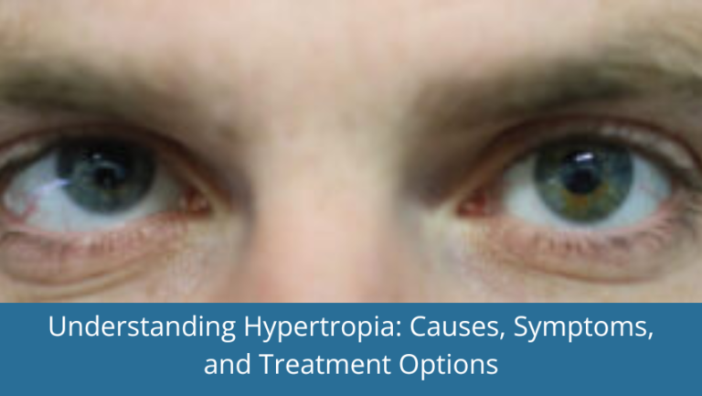 Understanding Hypertropia_ Causes, Symptoms, and Treatment Options
