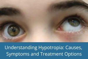 Hypotropia: Causes, Symptoms and Treatment