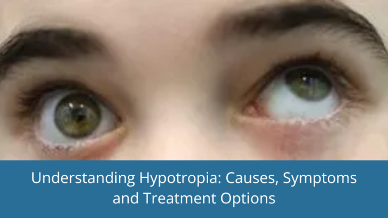 Understanding Hypotropia_ Causes, Symptoms and Treatment Options
