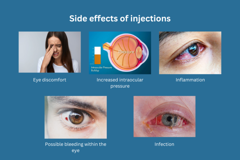 Side effects of Injections