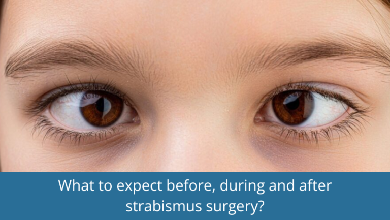 What to expect before, during and after strabismus surgery