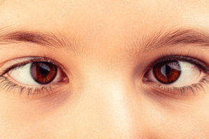 Strabismus surgery