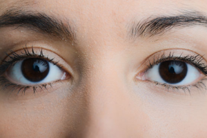 after strabismus surgery