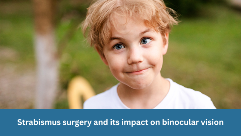 Strabismus surgery and its impact on binocular vision