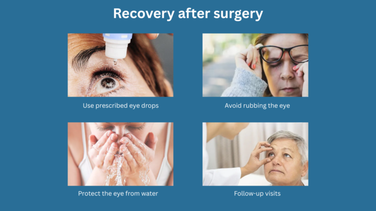 Recovery after surgery