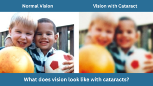 What does vision look like with cataracts?