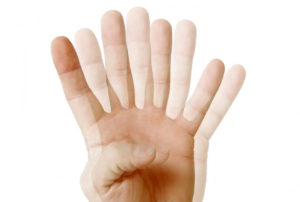 Double vision in one eye