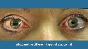 What are the different types of glaucoma?