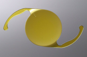 Toric IOLs (for Astigmatism)