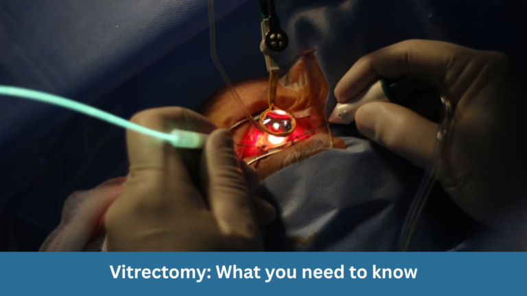 Vitrectomy: What you need to know