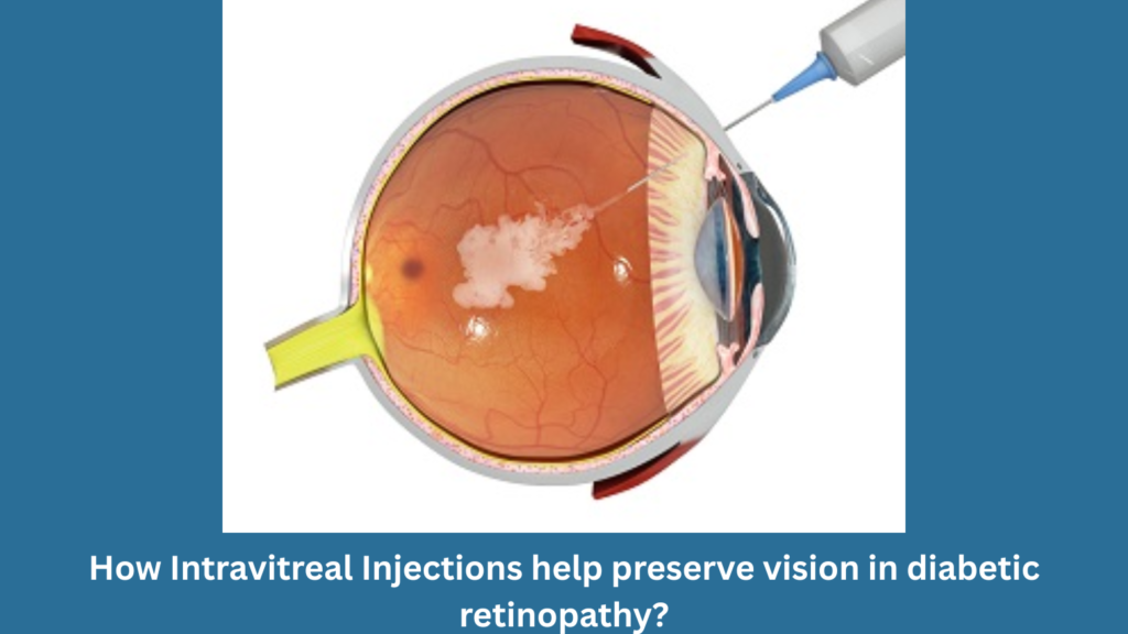 How intravitreal injections help preserve vision in diabetic retinopathy?