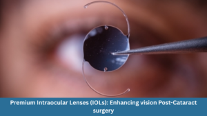 Premium Intraocular Lenses (IOLs): Enhancing vision Post-Cataract surgery