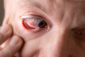 Can diabetic eye disease be reversed?