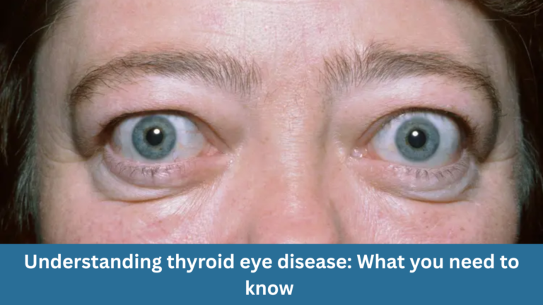 Understanding thyroid eye disease: What you need to know