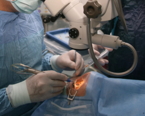 What happens during pterygium surgery?