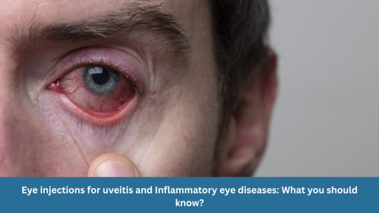 Eye injections for uveitis and inflammatory eye diseases: What should you know?