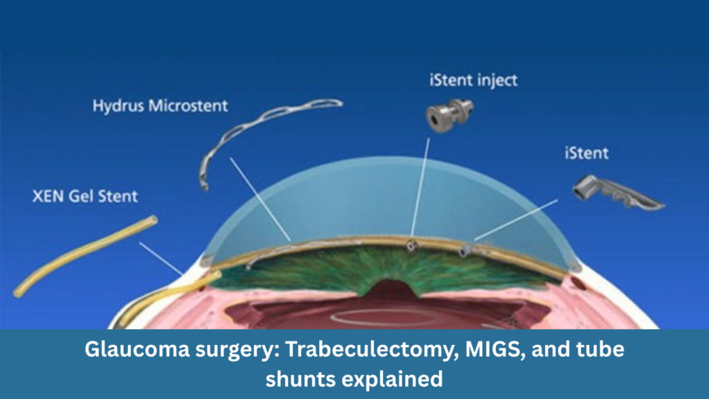 Glaucoma surgery: trabeculectomy, MIGS, and tube shunts explained