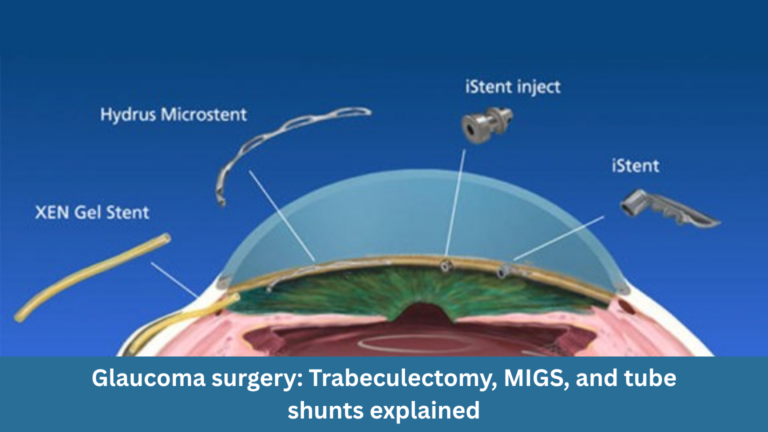 Glaucoma surgery: trabeculectomy, MIGS, and tube shunts explained