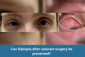 Diplopia