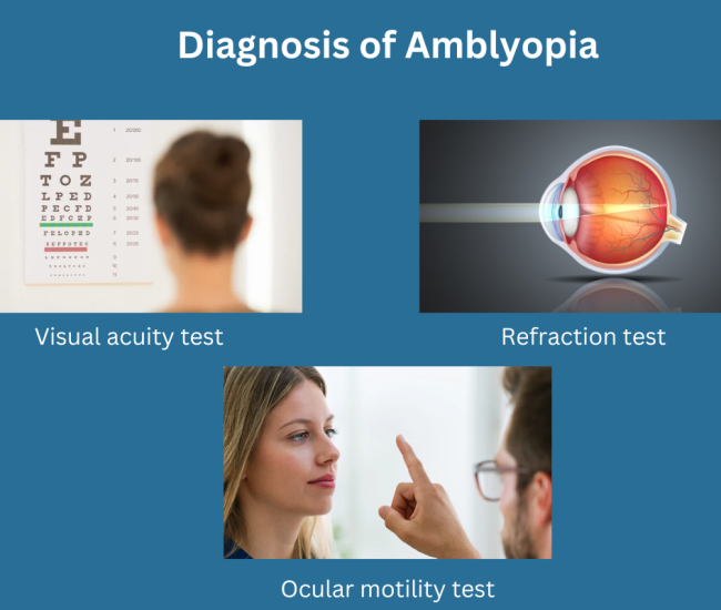 Diagnosis of Amblyopia Diagnosis of Amblyopia