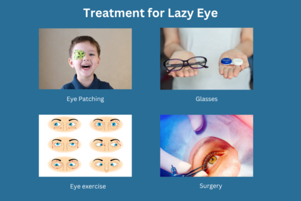Treatment for Lazy Eye